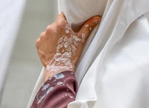 [116] Dolor Francisco Gonzalez